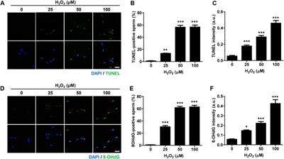 The Capacity to Repair Sperm DNA Damage in Zygotes is Enhanced by Inhibiting WIP1 Activity